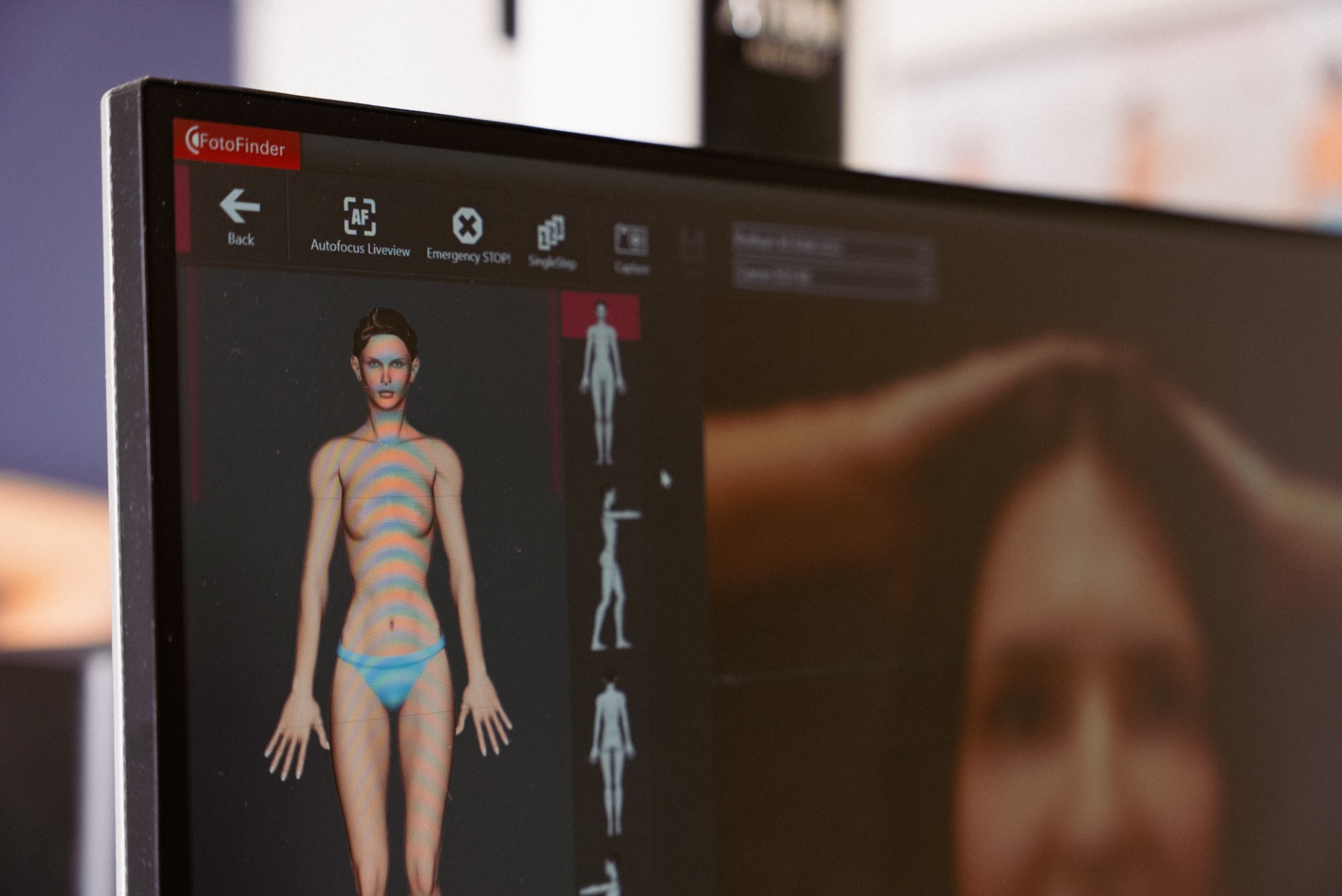 Full Body Skin Check + Mole Mapping appointment